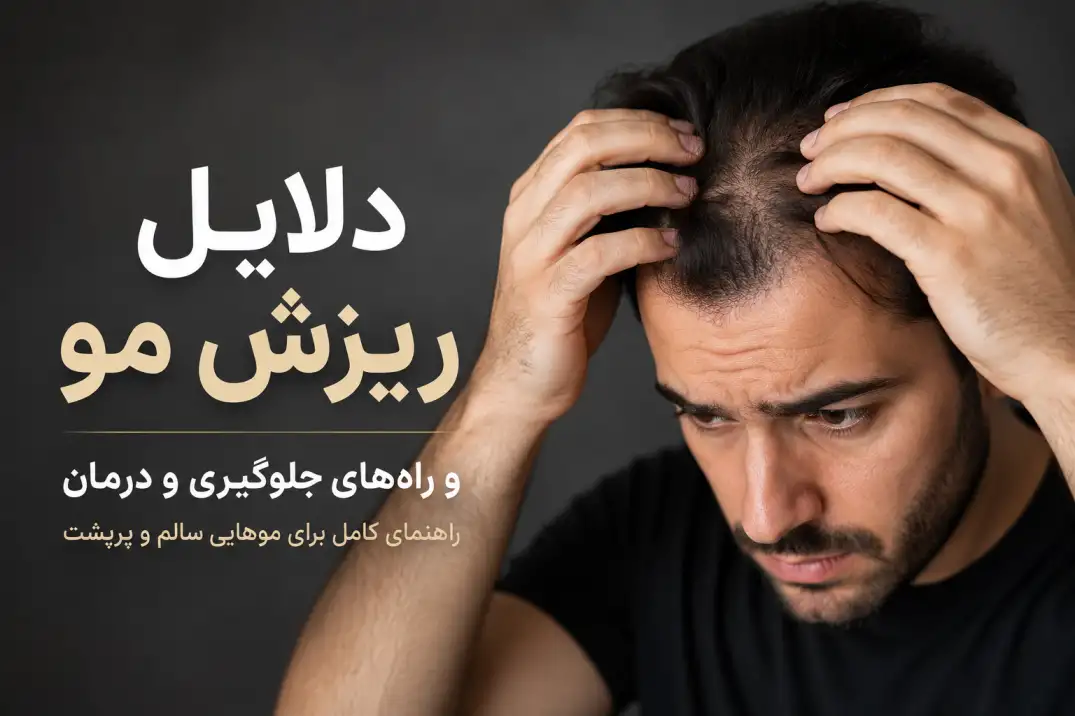 دلایل ریزش مو و راههای